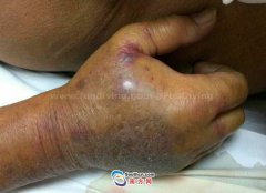 �����ʴ��˵��˿ڣ�С��ʳ�����Ⱦ